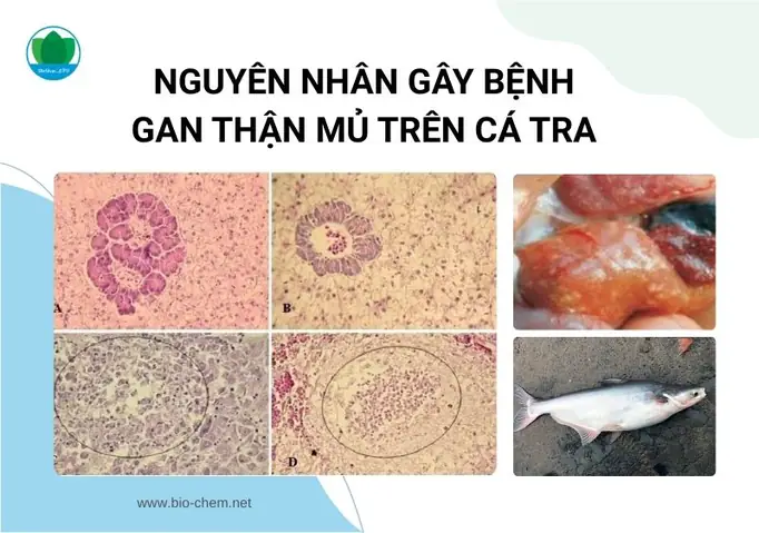 Nguyên nhân gây bệnh
