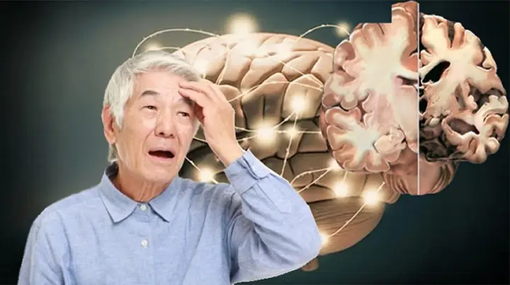 Điều trị Alzheimer