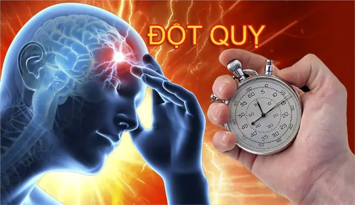 Ngăn ngừa đột quỵ