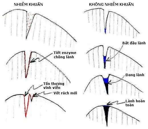 Cá Rồng Bị Tưa Đuôi: Nguyên Nhân, Cách Trị Và Phòng Ngừa Hiệu Quả