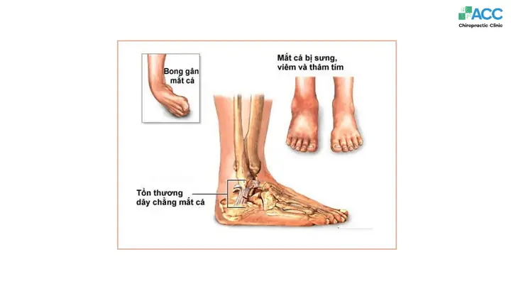 Cá Xương Là Gì? Đặc Điểm, Phân Loại và Tầm Quan Trọng Trong Thế Giới Thủy Sinh
