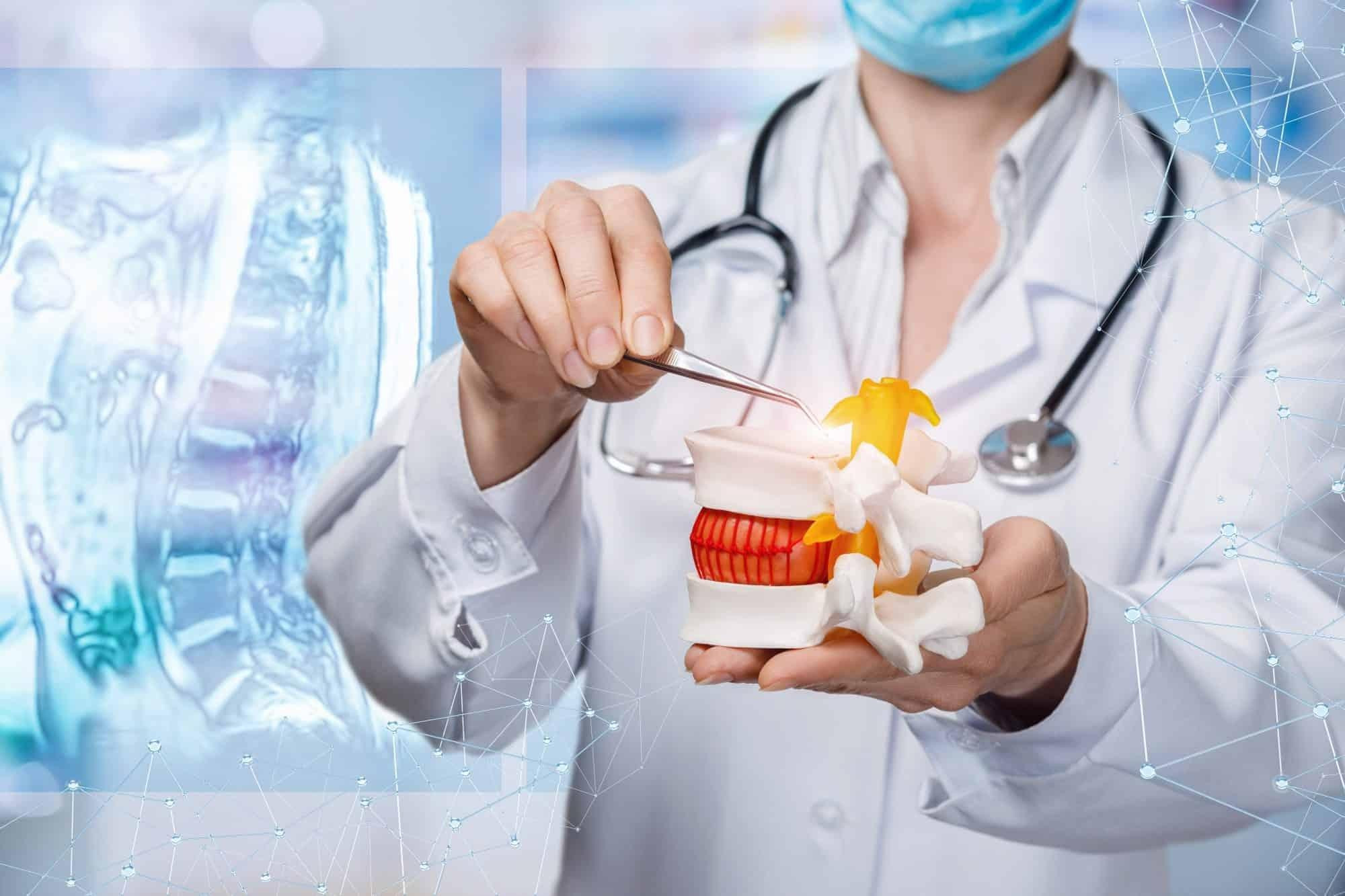 Hình ảnh mô phỏng quá trình điều trị thoát vị đĩa đệm để giảm bớt áp lực lên dây thần kinh, cải thiện tình trạng tê cả cánh tay.